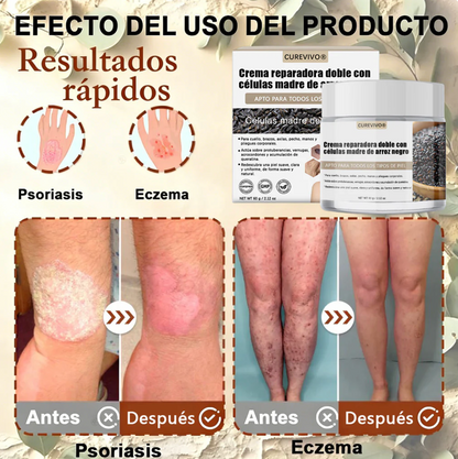 Certificación oficial 💎 𝐂𝐔𝐑𝐄𝐕𝐈𝐕𝐎® Crema reparadora dual con células madre de arroz negro